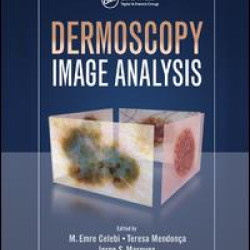 Dermoscopy Image Analysis Dermoscopy Image Analysis