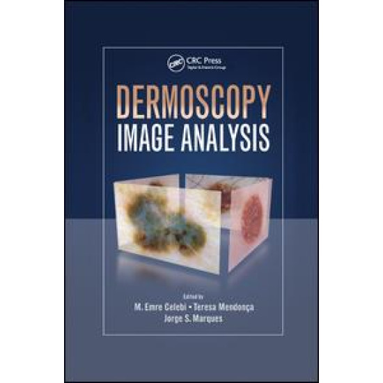 Dermoscopy Image Analysis Dermoscopy Image Analysis
