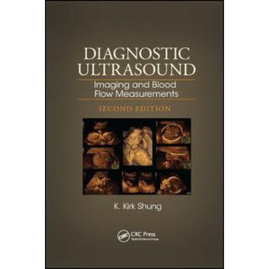 Diagnostic Ultrasound Diagnostic Ultrasound