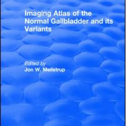 Imaging Atlas of the Normal Gallbladder and Its Variants