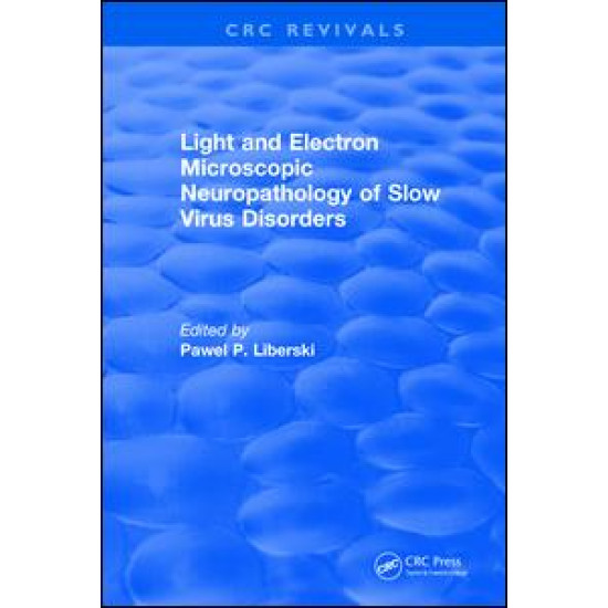 Light And Electron Microscopic Neuropathology of Slow Virus Disorders Light And Electron Microscopic Neuropathology of Slow Virus Disorders