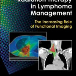 Image-Guided Radiation Therapy in Lymphoma Management Image-Guided Radiation Therapy in Lymphoma Management