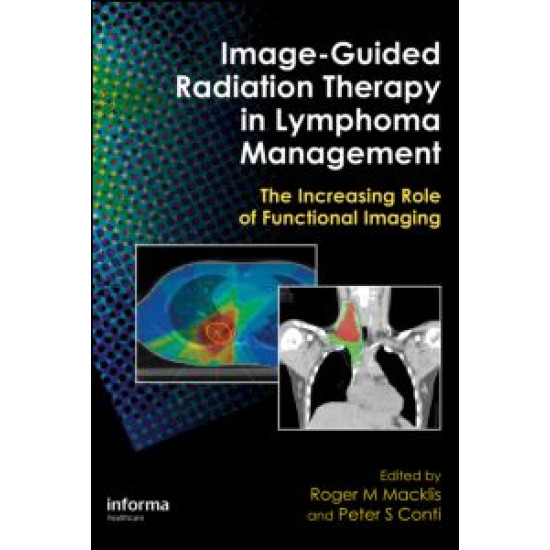Image-Guided Radiation Therapy in Lymphoma Management Image-Guided Radiation Therapy in Lymphoma Management