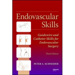 Endovascular Skills Endovascular Skills