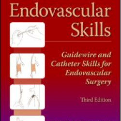 Endovascular Skills