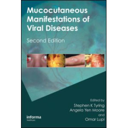 Mucocutaneous Manifestations of Viral Diseases