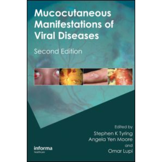 Mucocutaneous Manifestations of Viral Diseases Mucocutaneous Manifestations of Viral Diseases