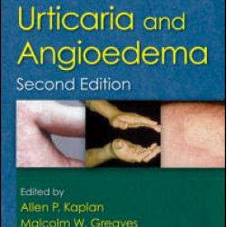 Urticaria and Angioedema