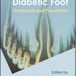 High Risk Diabetic Foot High Risk Diabetic Foot