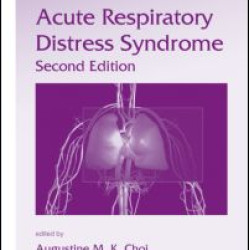 Acute Respiratory Distress Syndrome Acute Respiratory Distress Syndrome
