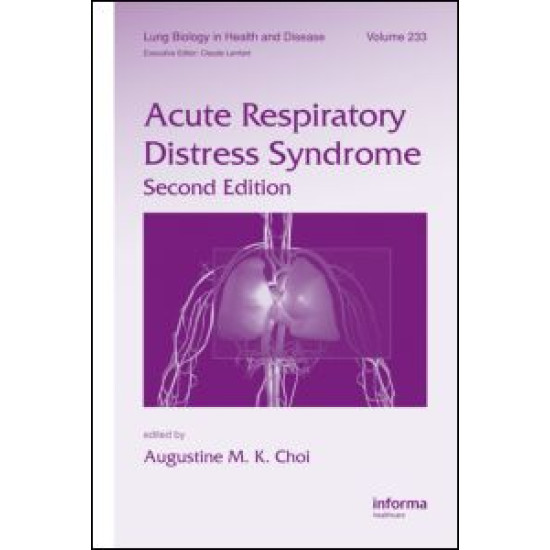 Acute Respiratory Distress Syndrome Acute Respiratory Distress Syndrome