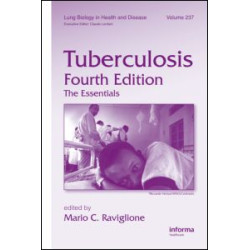 Tuberculosis Tuberculosis