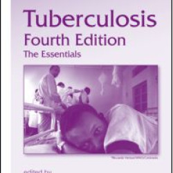 Tuberculosis Tuberculosis