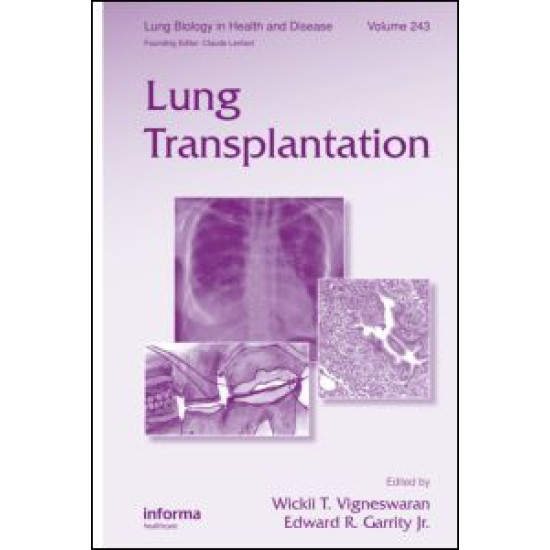 Lung Transplantation