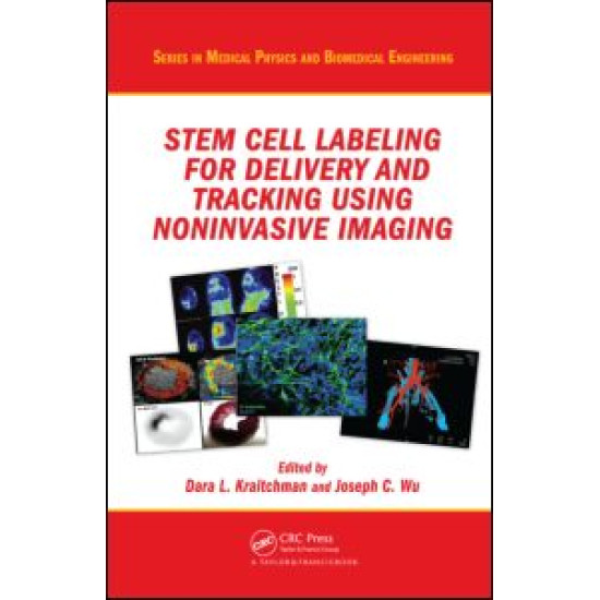 Stem Cell Labeling for Delivery and Tracking Using Noninvasive Imaging