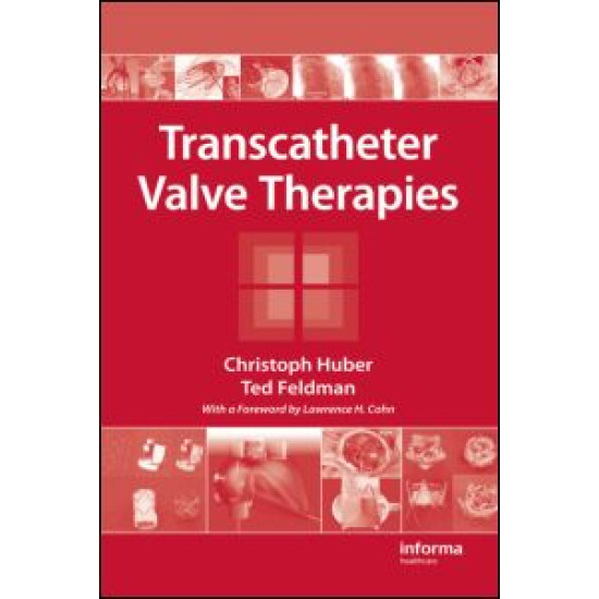 Transcatheter Valve Therapies Transcatheter Valve Therapies