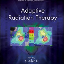 Adaptive Radiation Therapy Adaptive Radiation Therapy