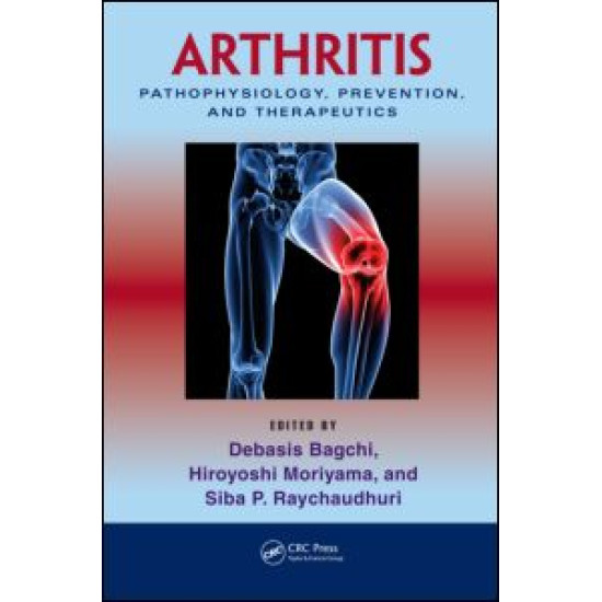 Arthritis