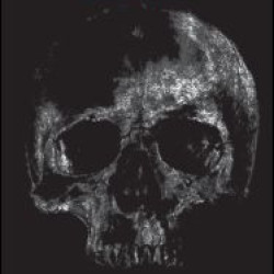 Security Patch Management Security Patch Management