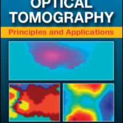 Diffuse Optical Tomography Diffuse Optical Tomography