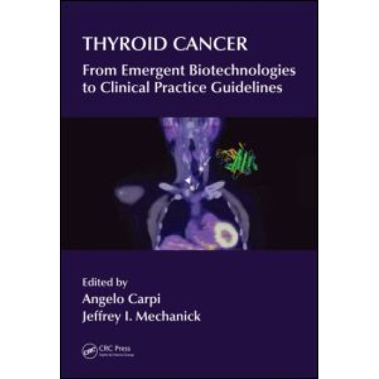 Thyroid Cancer Thyroid Cancer