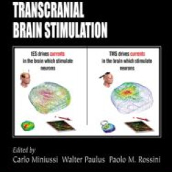 Transcranial Brain Stimulation Transcranial Brain Stimulation
