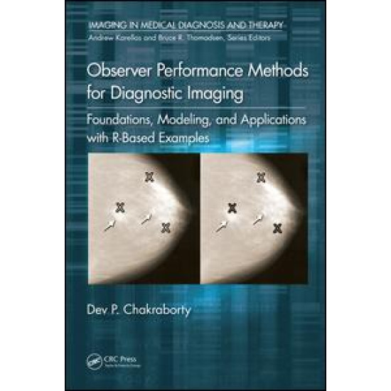 Observer Performance Methods for Diagnostic Imaging Observer Performance Methods for Diagnostic Imaging
