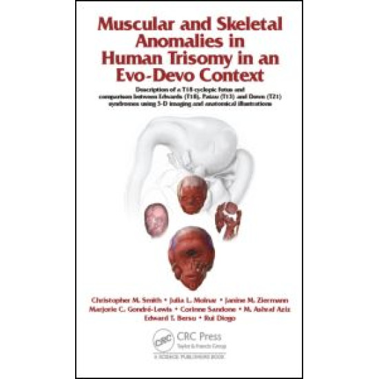 Muscular and Skeletal Anomalies in Human Trisomy in an Evo-Devo Context Muscular and Skeletal Anomalies in Human Trisomy in an Evo-Devo Context