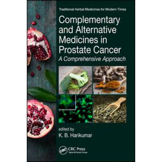 Complementary and Alternative Medicines in Prostate Cancer Complementary and Alternative Medicines in Prostate Cancer