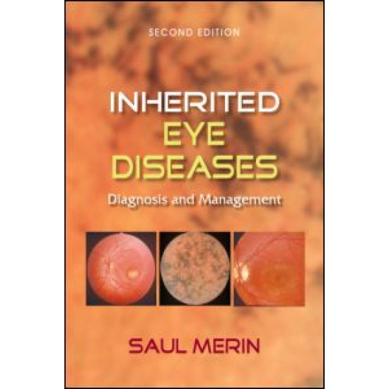 Inherited Eye Diseases