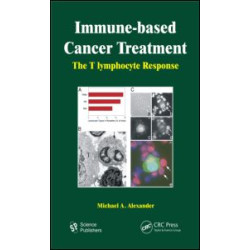 Immune-based Cancer Treatment Immune-based Cancer Treatment