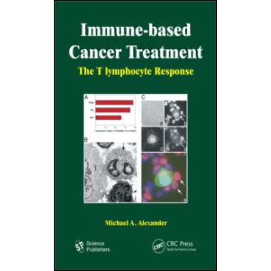 Immune-based Cancer Treatment Immune-based Cancer Treatment
