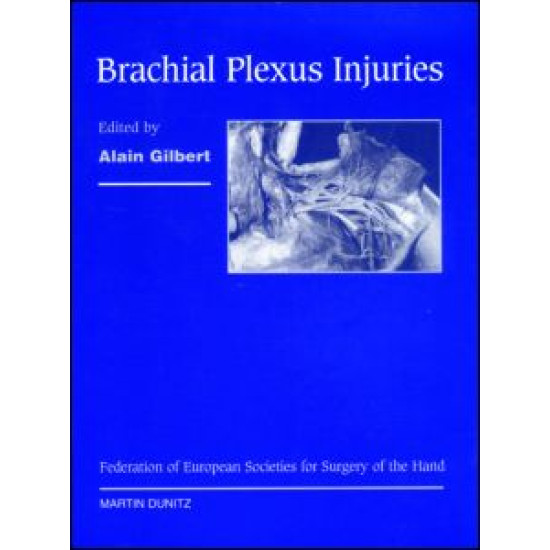 Brachial Plexus Injuries