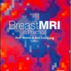 Breast MRI in Practice