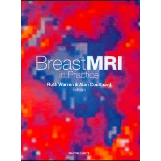 Breast MRI in Practice