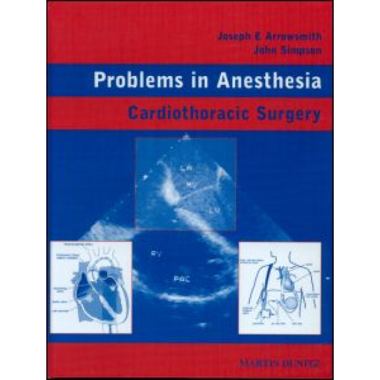 Cardiothoracic Surgery