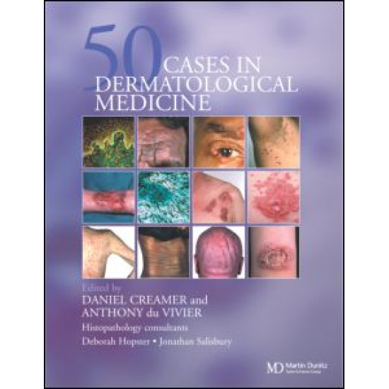 Fifty Dermatological Cases Fifty Dermatological Cases