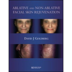 Ablative and Non-ablative Facial Skin Rejuvenation Ablative and Non-ablative Facial Skin Rejuvenation