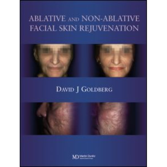 Ablative and Non-ablative Facial Skin Rejuvenation