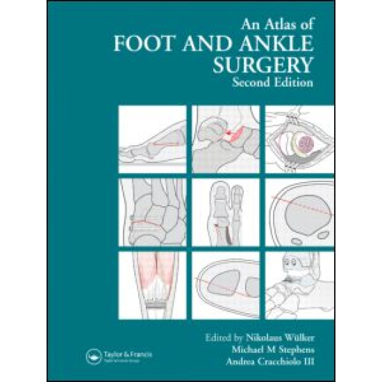 Atlas Foot and Ankle Surgery Atlas Foot and Ankle Surgery