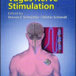 Vagus Nerve Stimulation Vagus Nerve Stimulation