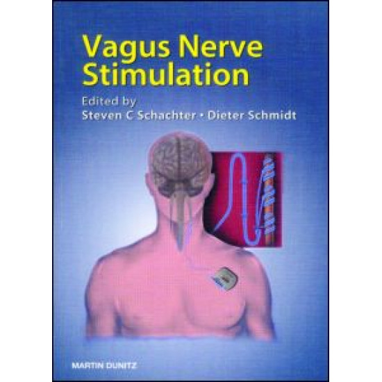Vagus Nerve Stimulation Vagus Nerve Stimulation