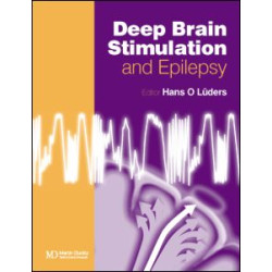 Deep Brain Stimulation and Epilepsy
