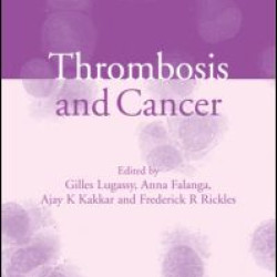 Thrombosis and Cancer Thrombosis and Cancer