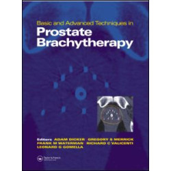 Basic and Advanced Techniques in Prostate Brachytherapy