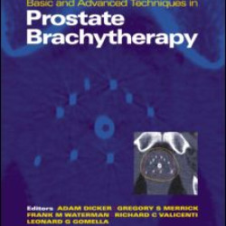 Basic and Advanced Techniques in Prostate Brachytherapy Basic and Advanced Techniques in Prostate Brachytherapy