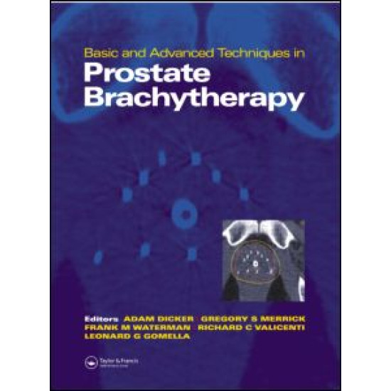 Basic and Advanced Techniques in Prostate Brachytherapy Basic and Advanced Techniques in Prostate Brachytherapy