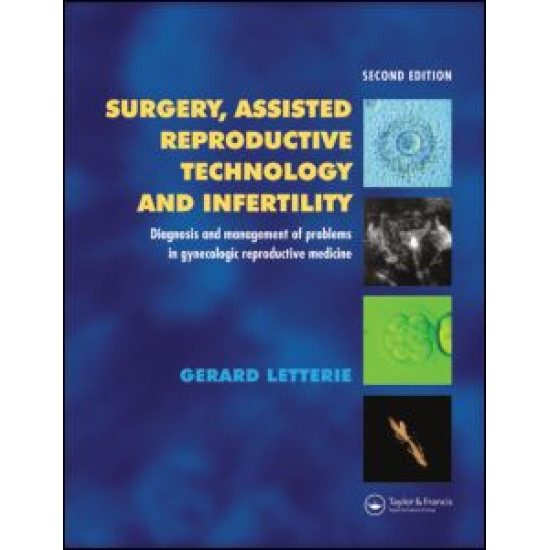 Surgery, Assisted Reproductive Technology and Infertility Surgery, Assisted Reproductive Technology and Infertility