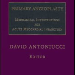 Primary Angioplasty Primary Angioplasty