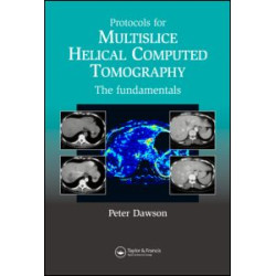 Protocols for Multislice Helical Computed Tomography Protocols for Multislice Helical Computed Tomography